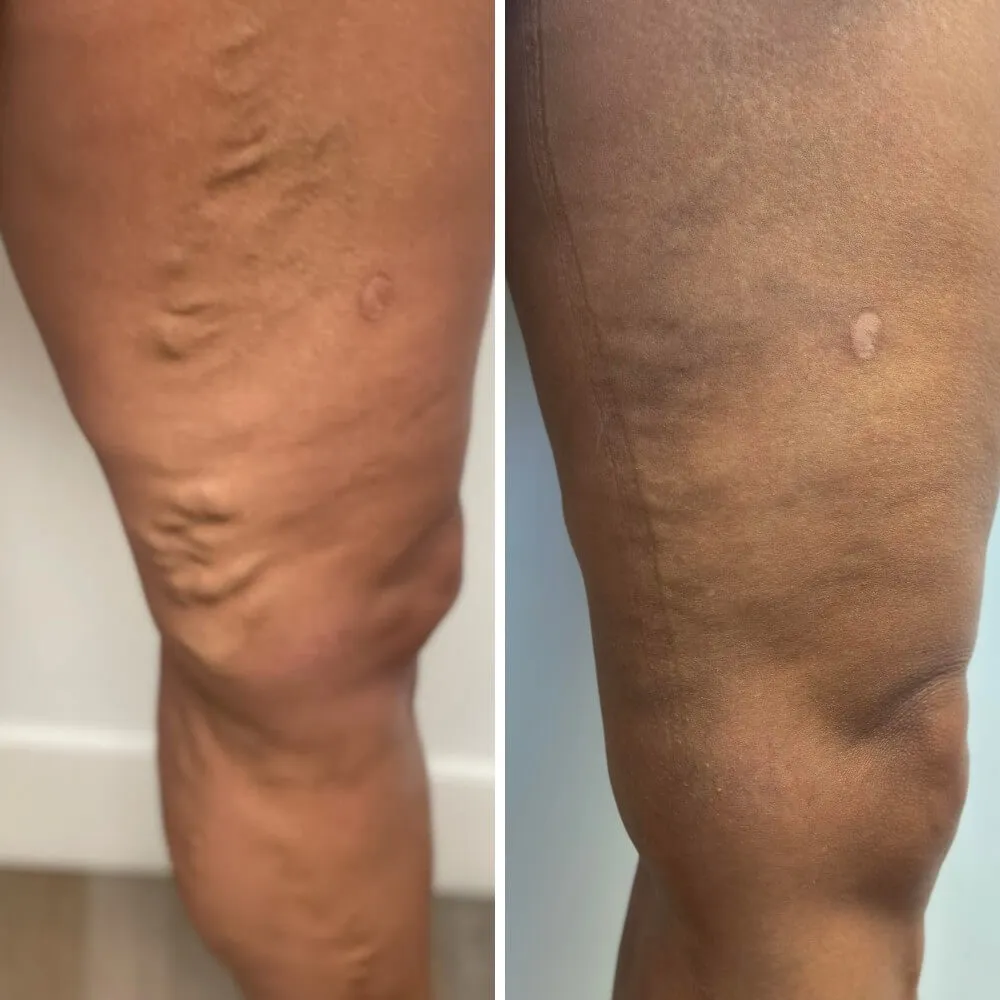 before after photos