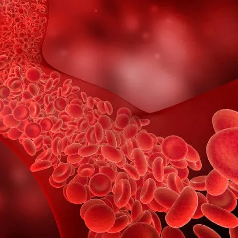blood clots