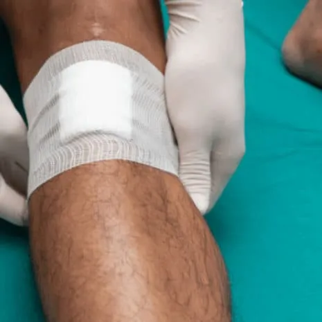 leg ulcers